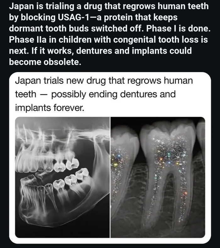 Japan Initiates Clinical Trials for Drug Designed to Regrow Human Teeth - Interesting on Aviaclip