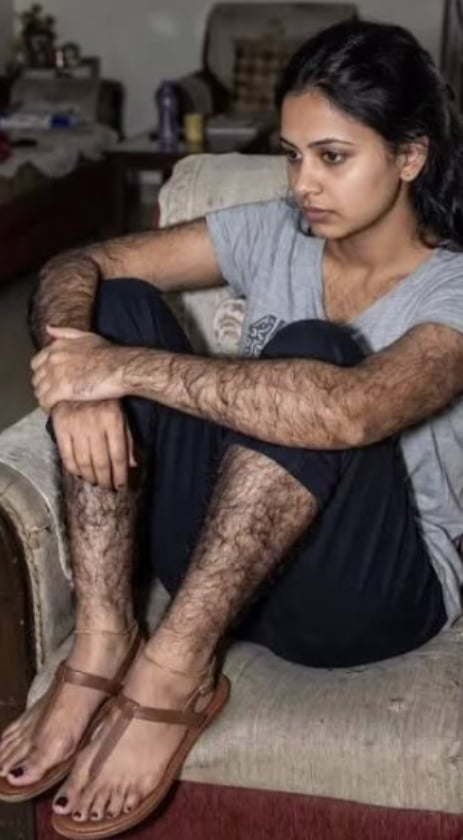 Viral Image Sparks Debate on Body Hair Preferences