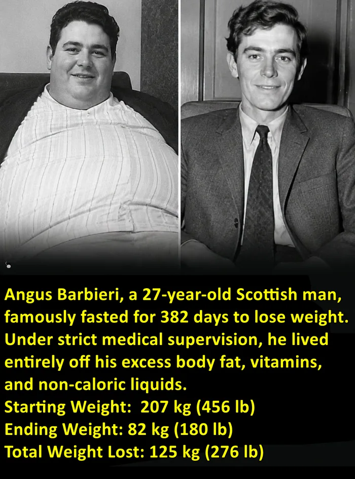 The Incredible Story of Angus Barbieri: The Man Who Fasted for 382 Days
