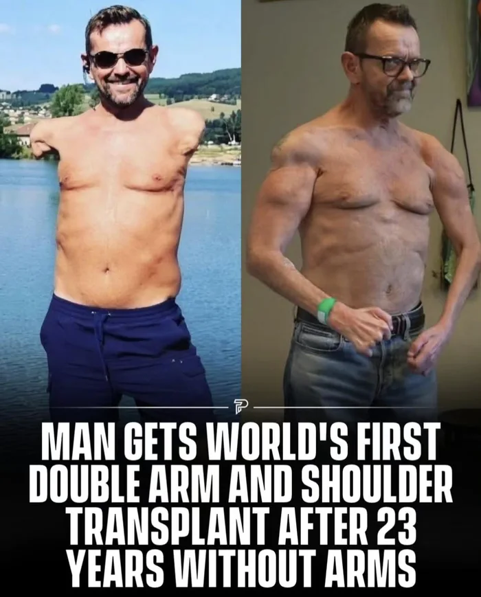 He's now losing his nose to cancer... I wish I was joking