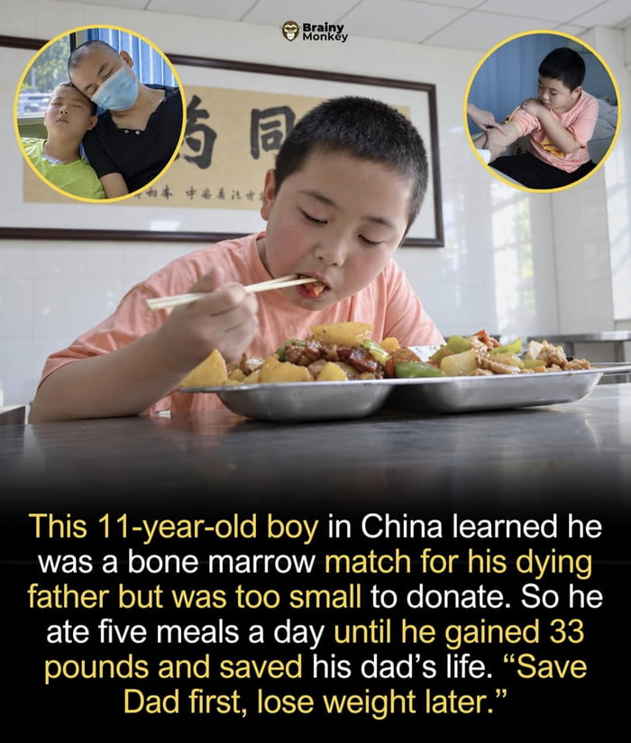 Young Boy Gains Weight to Become Bone Marrow Donor for His Father
